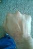 boxers fracture??-imag0122.jpg